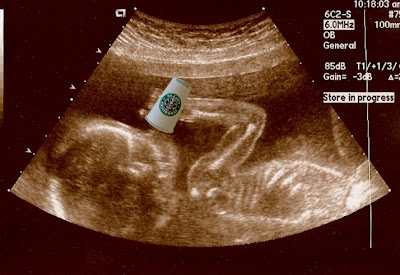 ultrasound funny sonogram birth starbucks quotes babies fetus photographer giving womb awards xanaland really ted ct laughs give creative coffee