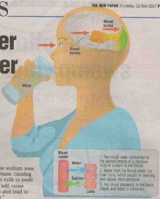 Water In Brain