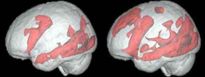 University of California - Brain Scans of Silver Surfer (1) reading a book and (2) searching the Internet (2008)