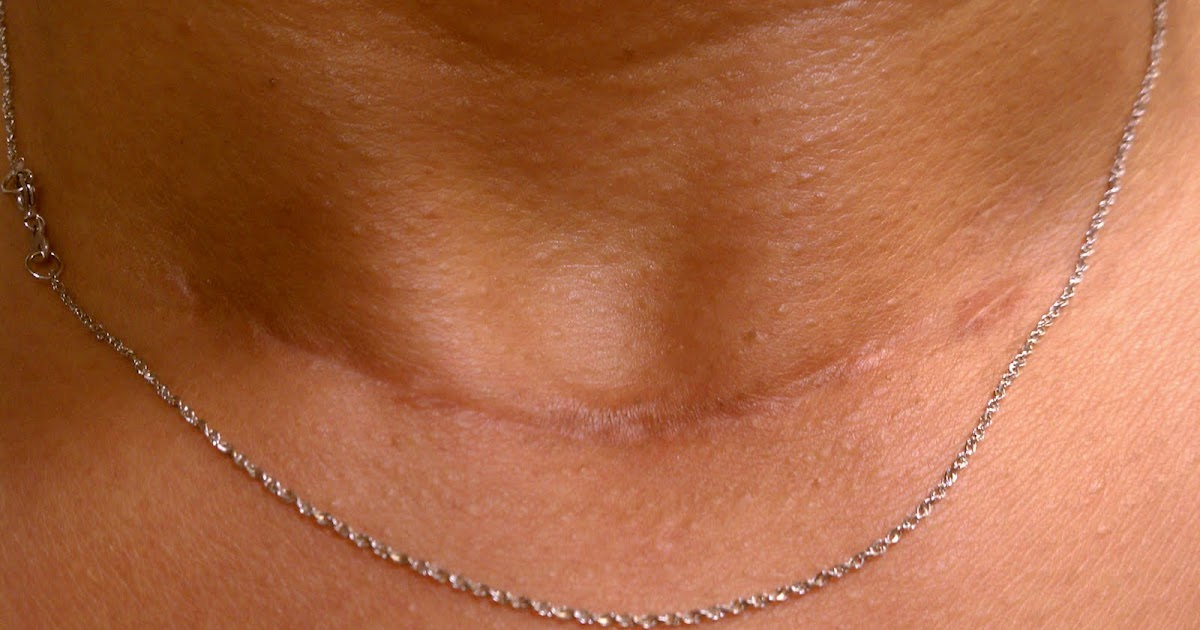 How does my neck look? How does my neck look? 9/10/10