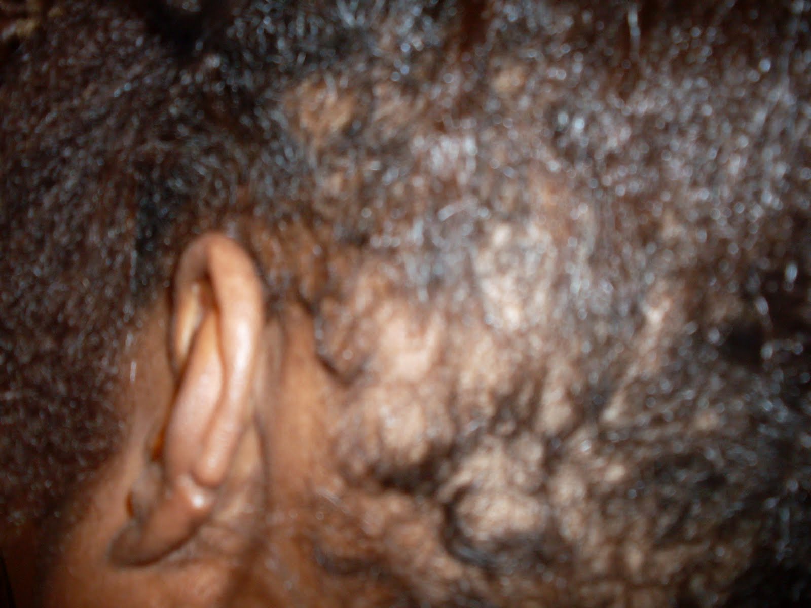 Natural Hair Bald Spots Are Filling In