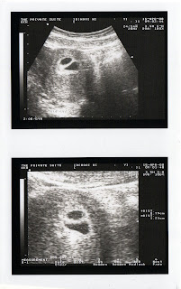 first scan how many weeks