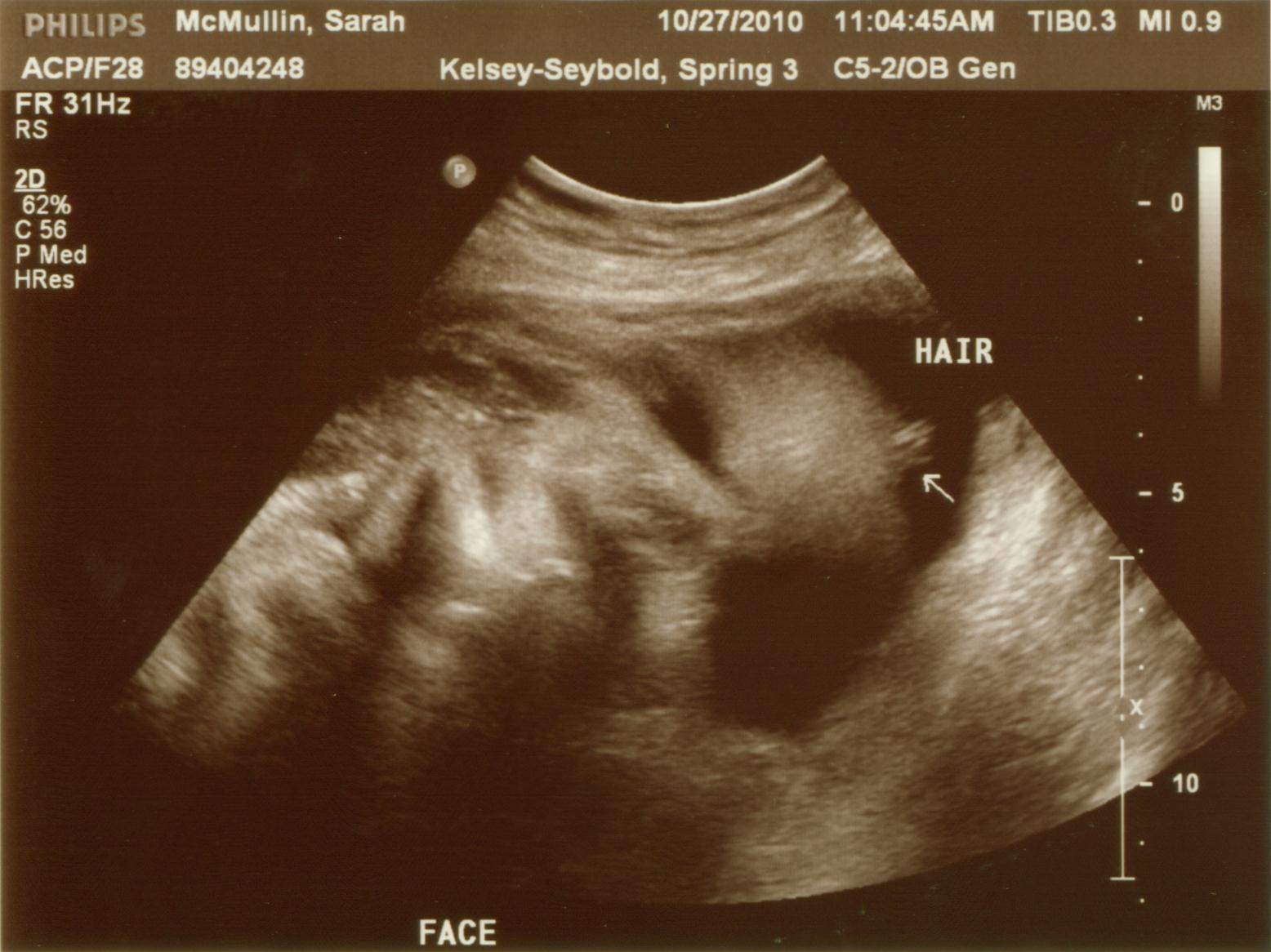 Ryan, Sarah, Duggle, & Dot Baby Skeleton Face