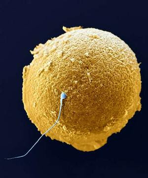 கோடி உயிரில் ஒரு உயிர் - வித்தியாசமான புகைப்படம் Sperm+Cells+%283%29