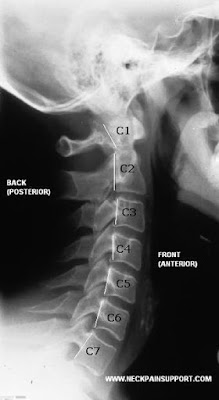 Spinal Cord Alignment