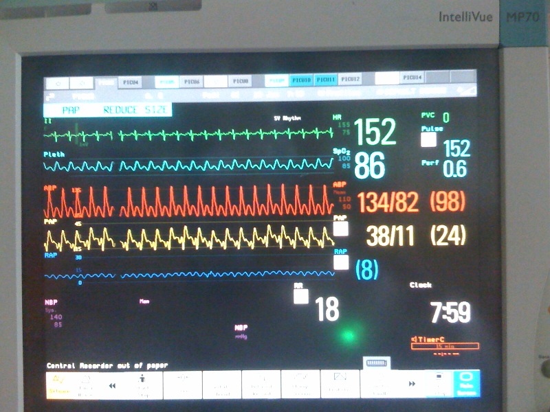 cardiac ultrasound practical cardiac diagnosis