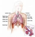 mesothelioma incidence