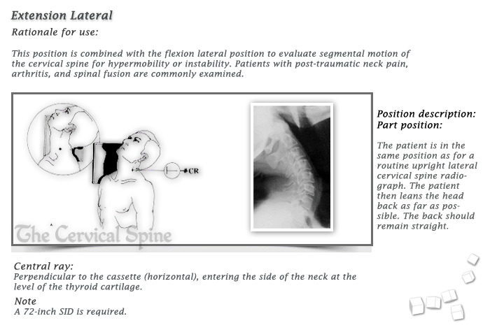 apical lordotic