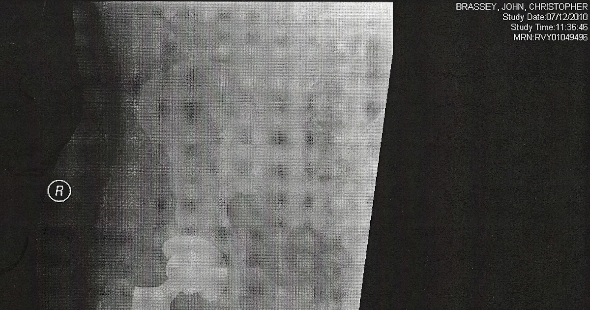 Notes From Retirement......................Where did the years go? NHS