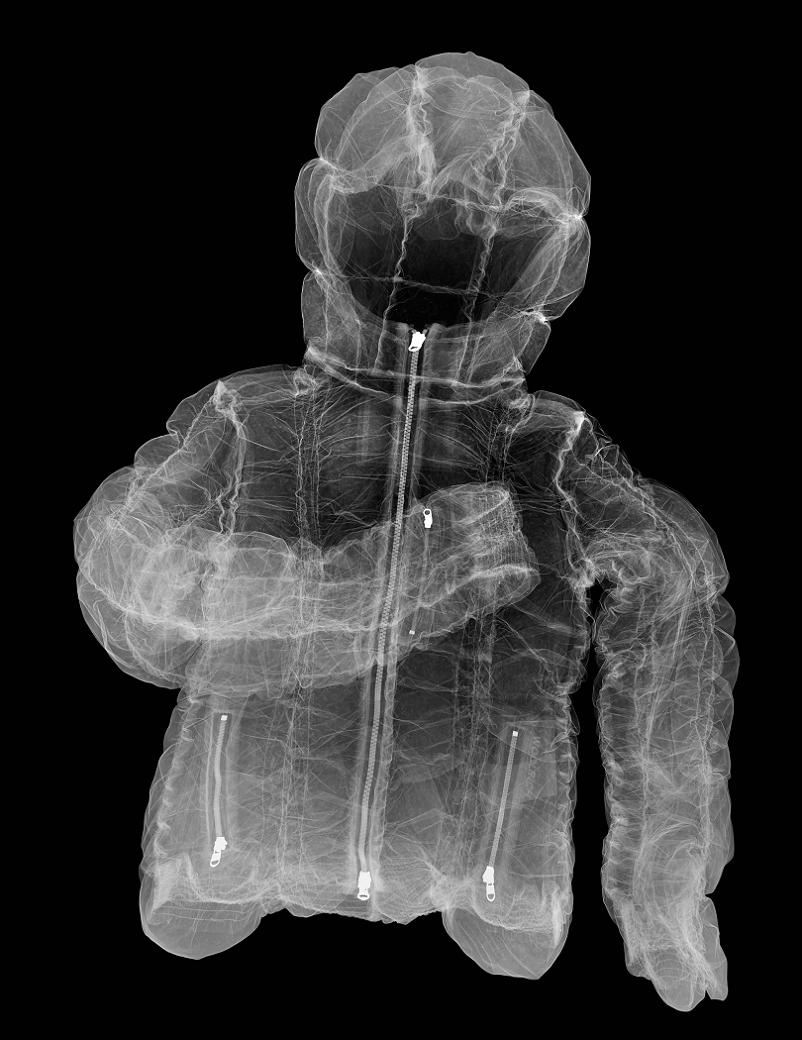 x-ray-of-jacket.jpg