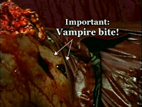 vampire bite