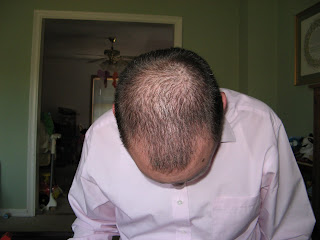 my blad head