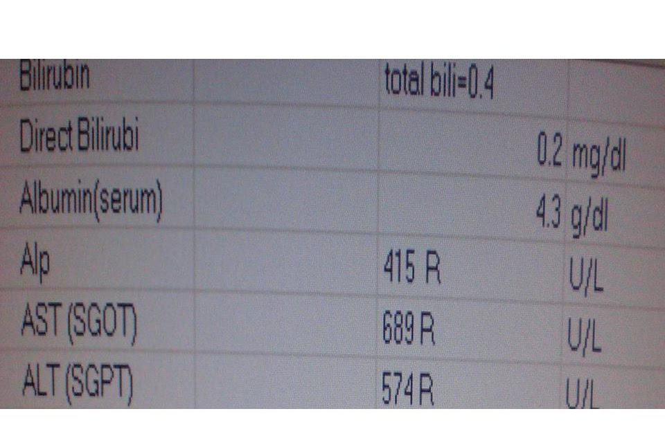 Phimaimedicine 123. Elevated liver enzyme in human immunodeficiency