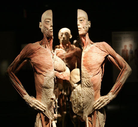 BODIES could be executed