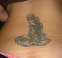 Stretch Marks Causes,Prevention Remedies 