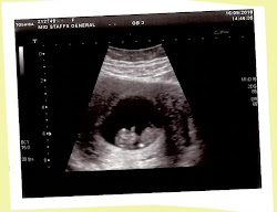 Baby's First Scan - 10+2