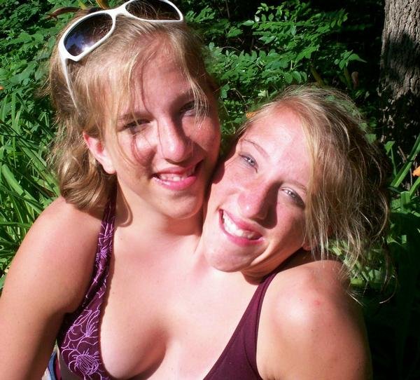 [siames_twins_08.jpg]