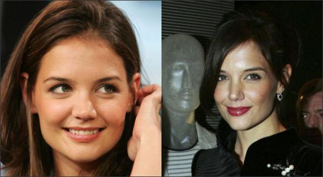 Celebrity Nose Job Before and After.