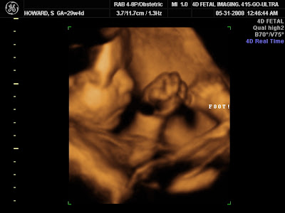 Project Howard: 3D Ultrasound o...