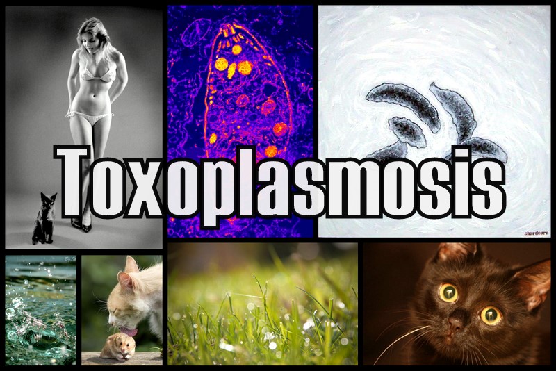 Toxoplasmosis