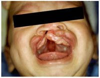 femme enceinte qui fume femme enceinte qui fume
