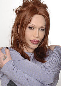 bad plastic surgery?