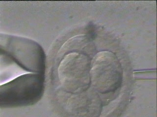 stem cells being extracted from embryo