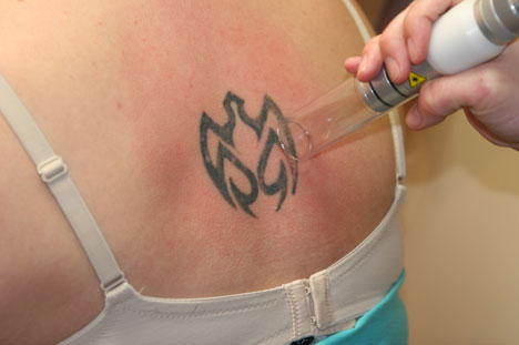 remove tattoos.0a · remove tattoos.0b remove their tattoos remove tattoos.0a · remove tattoos.0b remove their tattoos