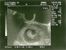 Baby Eaton:Coming October, 2009!