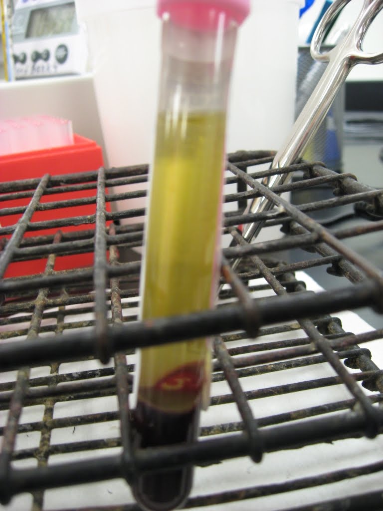 Antijenic Drift Blood Bank Expiration Dates (Red Cells)