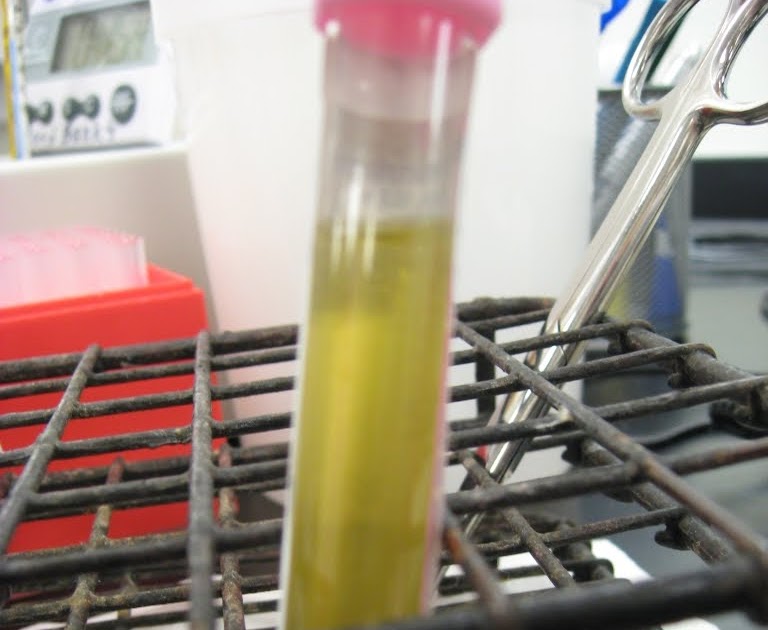 Antijenic Drift Blood Bank Expiration Dates (Red Cells)