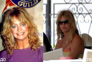 Goldie Hawn before and after pics