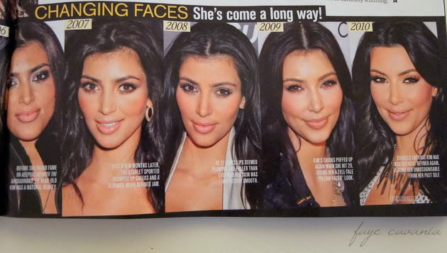 kim kardashian plastic surgery 2011. Kim Kardashian quot;Beforequot; and