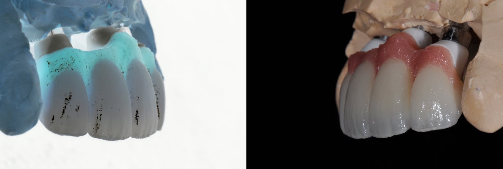 Niche Dental Studio Bisque Tryin