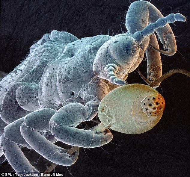 dailypetfwd A bed bug's eye view The terrifying insects that lurk in