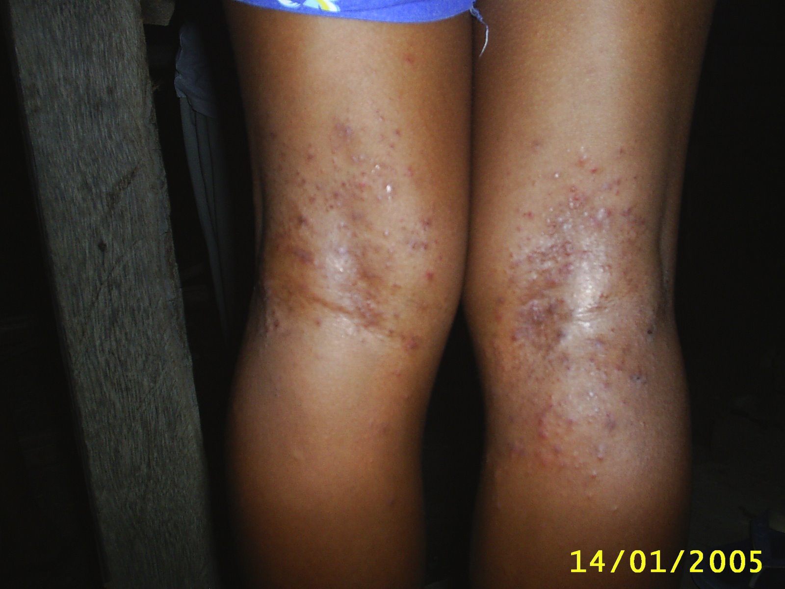 [Rusna+Lajurani.jpg]