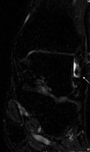 [os+subfibularis4.jpg]