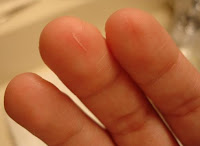 Why do paper cuts hurt so much?