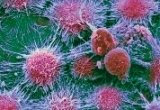 Kidney Cancer Cell