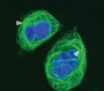 Ovary Cancer Cell