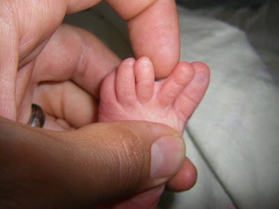 Webbed Toes