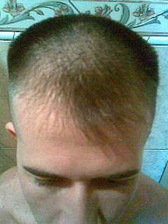 finasteride maxpil precio finasteride maxpil precio