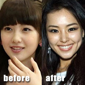  Plastic Surgery  on Is This The Best Plastic Surgery Ever