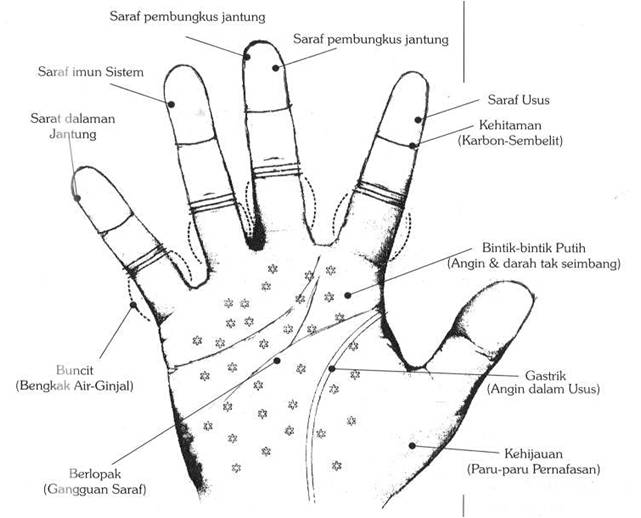 Deteksi Penyakit Lewat Telapak Tangan ~ Tung itu Ali
