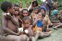 Kelaparan HAM Di Papua
