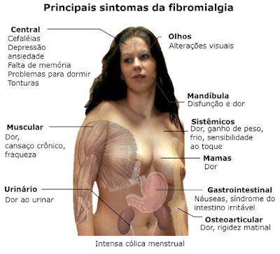 Fibromialgia - Sintomas