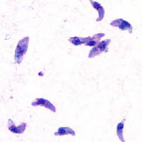 Toxoplasmose - Toxoplasma gondii