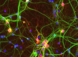 Mouse Striatal Neurons in Culture