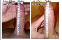 Testosterone injections side effects in men