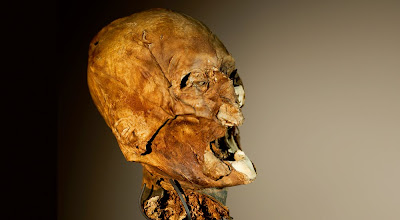 http://3.bp.blogspot.com/_poCtb9ZLZIU/TQnWqcPy0dI/AAAAAAAAA18/isqeFxTTL5c/s1600/Henri-IV-Henri-IV-tete-momifiee.jpg